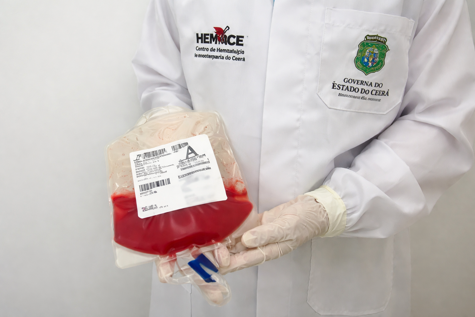 Ceará atinge marca de mil transplantes de medula óssea pelo SUS com apoio do Hemoce