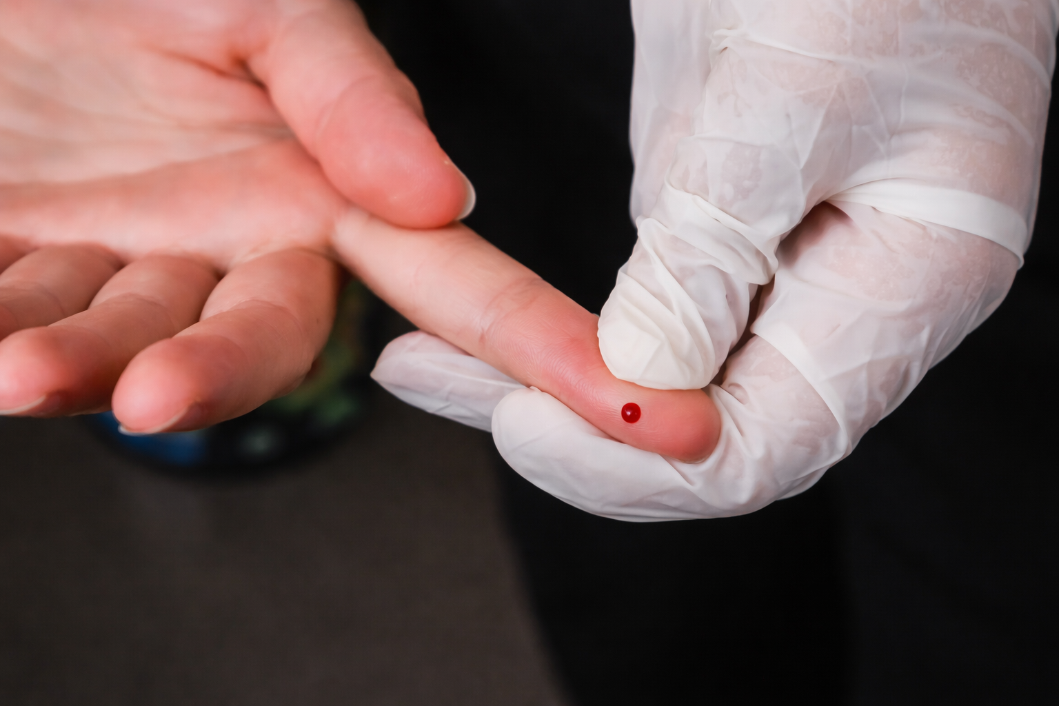 SUS passa a oferecer teste rápido de dengue gratuitamente em postos e hospitais públicos