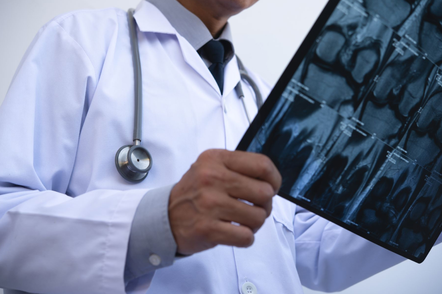 Cinco tipos de câncer que mais matam no Ceará e como se prevenir